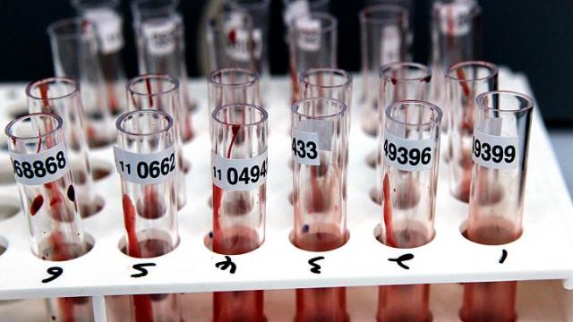 The number of homosexual and bisexual cases has risen from 166 in 2009 to 247 last year. Action for Aids says the rise could be due to the availability of effective anti-retroviral medication and a degree of "condom fatigue" in Singapore. -- ST FILE PHOTO - See more at: http://www.straitstimes.com/news/singapore/health/story/worrying-rise-hiv-cases-among-gay-men-20140605#sthash.jGH56AcL.dpuf